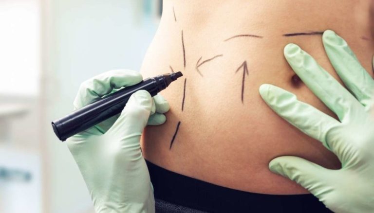 Correcting Your Imperfections Can Be Done With Ease