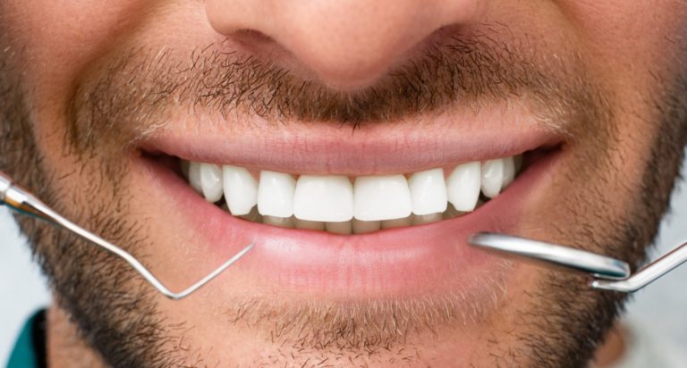 What are the Factors That Can Affect Dental Implant Success?