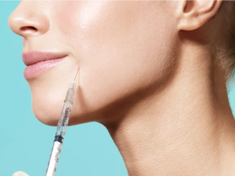 What Causes Double Chins and How to Remove Them