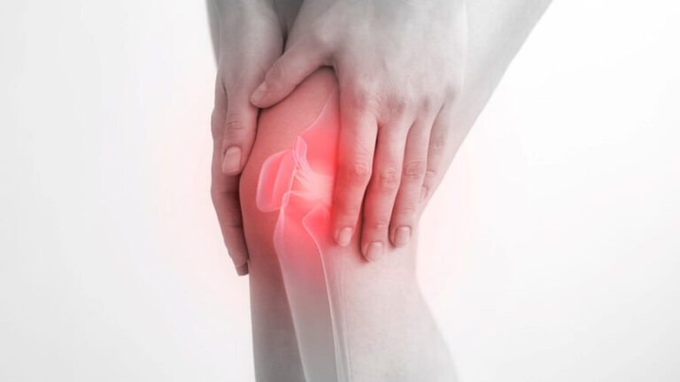 Top 4 Tips for Keeping Your Joints Healthy This Winter Joints Healthy This Winter