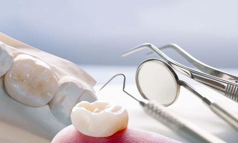 Detailed Information About Dental Bone Transplantation Detailed Information About Dental Bone Transplantation
