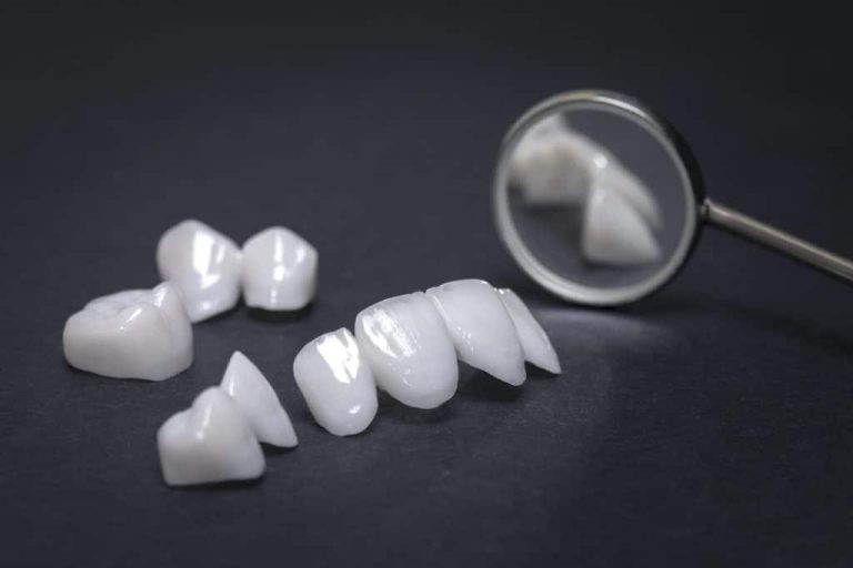 All types of All-Ceramic Dental Veneers