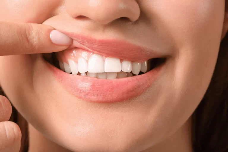 Best At‑Home Teeth Whitening Kits for Busy Women