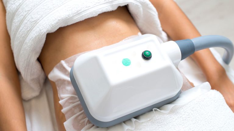 Understanding the CoolSculpting Process from Start to Finish