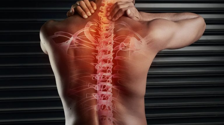 The Impact of Spinal Stenosis on Mobility and What You Can Do About It Spinal Stenosis