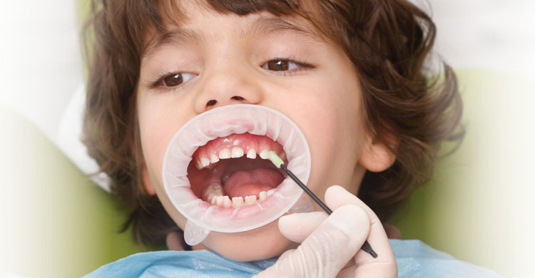 Understanding the Benefits of Using Oral Swabs for Children’s Teeth