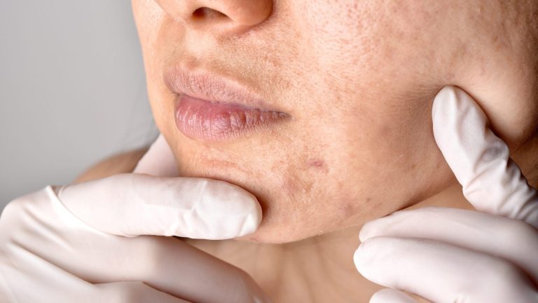 Comprehensive Arizona Dermatology Services for Healthy Skin