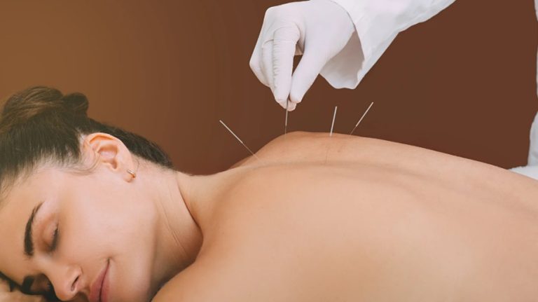 Acupuncture vs. Traditional Medicine: Which Is Better for Chronic Pain? Better for Chronic Pain