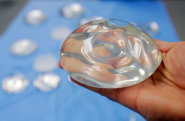 Understanding The Long-Term Health Effects Of Breast Implants